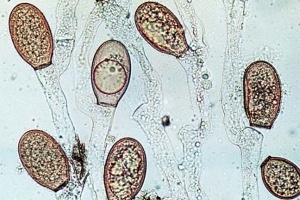 Exemplo de fungos do Filo Chytridiomycota.  
