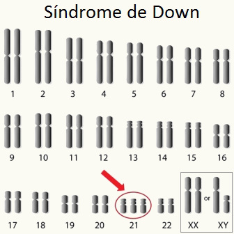 Observe a presença de três cromossomos 21
